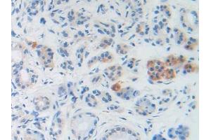 DAB staining on IHC-P; Samples: Human Stomach Tissue (BNP antibody  (AA 27-134))
