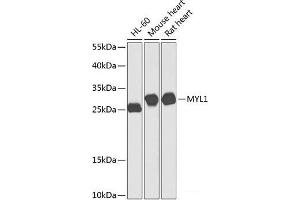 Western blot analysis of extracts of various cell lines using MYL1 Polyclonal Antibody at dilution of 1:1000. (MYL1 antibody)