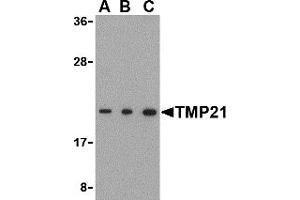 Western Blotting (WB) image for anti-Transmembrane Emp24-Like Trafficking Protein 10 (TMED10) (C-Term) antibody (ABIN1030758) (TMED10 antibody  (C-Term))