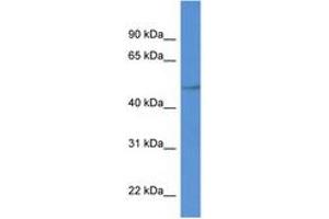Image no. 1 for anti-Phospholipid Transfer Protein (PLTP) (C-Term) antibody (ABIN6749777) (PLTP antibody  (C-Term))