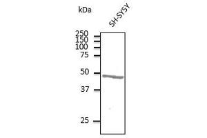 Anti-ATXN3 Ab at 1/500 dilution, lysates at 100 µg per Iane, rabbit polyclonal to goat lgG (HRP) at 1/10,000 dilution, (Ataxin 3 antibody  (AA 120-250))