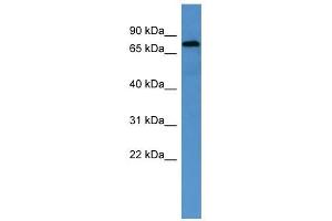 ACO2 antibody used at 1 ug/ml to detect target protein. (ACO2 antibody  (Middle Region))