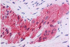 Human Colon, Myenteric Plexus: Formalin-Fixed, Paraffin-Embedded (FFPE) (KLF2 antibody  (AA 216-265))