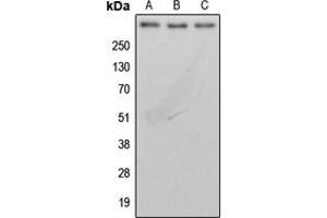 Western blot analysis of BRCA2 expression in MDAMB231 (A), MCF7 (B), rat lung (C) whole cell lysates. (BRCA2 antibody  (N-Term))