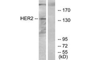 Western blot analysis of extracts from 293 cells, using HER2 Antibody.