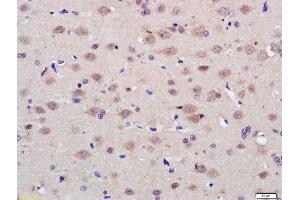 Paraformaldehyde-fixed, paraffin embedded rat brain tissue, Antigen retrieval by boiling in sodium citrate buffer(pH6) for 15min, Block endogenous peroxidase by 3% hydrogen peroxide for 30 minutes, Blocking buffer (normal goat serum) at 37°C for 20min, Antibody incubation with Rabbit Anti-PAG1 Polyclonal Antibody, Unconjugated  at 1:200 overnight at 4°C, followed by a conjugated secondary and DAB staining (PAG1 antibody  (AA 331-432))