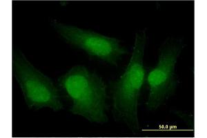 Immunofluorescence of monoclonal antibody to IRF3 on HeLa cell. (IRF3 antibody  (AA 1-452))