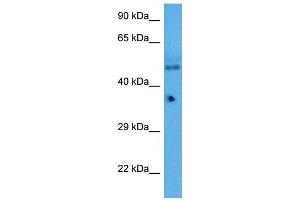 Host:  Rabbit  Target Name:  KLF5  Sample Tissue:  Mouse Pancreas  Antibody Dilution:  1ug/ml (KLF2 antibody  (Middle Region))
