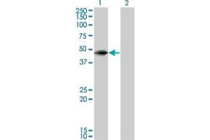 Western Blot analysis of ANGPTL5 expression in transfected 293T cell line by ANGPTL5 monoclonal antibody (M01), clone 1B2.