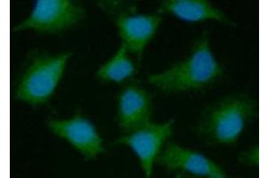 anti-Proteasome (Prosome, Macropain) 26S Subunit, Non-ATPase, 10 (PSMD10) (AA 1-226) antibody