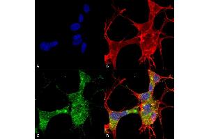 Immunocytochemistry/Immunofluorescence analysis using Mouse Anti-GFAP Monoclonal Antibody, Clone S206A-8 (ABIN1740957). (GFAP antibody  (AA 411-422) (FITC))