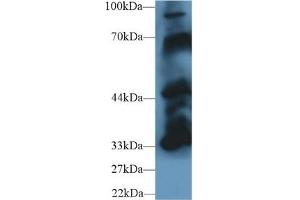 Detection of PTPN5 in Mouse Cerebrum lysate using Polyclonal Antibody to Protein Tyrosine Phosphatase, Non Receptor Type 5 (PTPN5) (PTPN5 antibody  (AA 270-533))