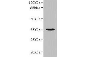 Western blot All lanes: NUBPL antibody at 1 μg/mL + A431 whole cell lysate Secondary Goat polyclonal to rabbit IgG at 1/10000 dilution Predicted band size: 35, 19 kDa Observed band size: 35 kDa (NUBPL antibody  (AA 39-319))