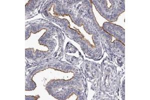 Immunohistochemical staining (Formalin-fixed paraffin-embedded sections) of human fallopian tube with GPRC5C polyclonal antibody  shows membrane positivity in glandular cells. (GPRC5C antibody)