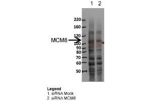 MCM8 WB Sample: siRNA Mock and siRNA MCM8 Dilution 1:1000 (MCM8 antibody  (N-Term))