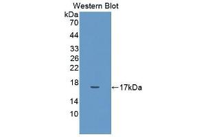Western blot analysis of the recombinant protein. (IL-17 antibody  (AA 20-155))