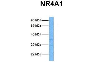 Western Blotting (WB) image for anti-Nuclear Receptor Subfamily 4, Group A, Member 1 (NR4A1) (N-Term) antibody (ABIN2777511)