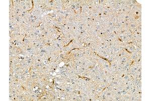 ABIN7093250 and ABIN7097267 at 1/100 staining Rat brain tissue by IHC-P. (NCF1 antibody  (pSer345))