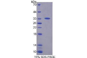 SDS-PAGE (SDS) image for N-Methylpurine-DNA Glycosylase (MPG) (AA 221-296), (AA 70-220) protein (His tag) (ABIN2121746) (MPG Protein (AA 70-220, AA 221-296) (His tag))
