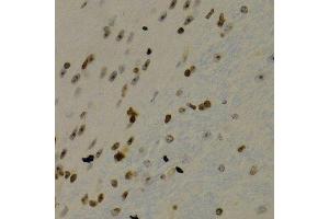 Immunohistochemistry (Paraffin-embedded Sections) (IHC (p)) image for anti-Nuclear Factor of kappa Light Polypeptide Gene Enhancer in B-Cells 2 (NFKB2) (AA 690-899) antibody (ABIN3017388)