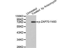 Western blot analysis of extracts from JK cells, using Phospho-ZAP70-Y493 antibody. (ZAP70 antibody  (pTyr493))