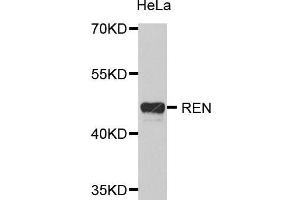 Western Blotting (WB) image for anti-Renin (REN) (AA 24-160) antibody (ABIN6218656) (Renin antibody  (AA 24-160))