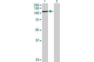 ZFYVE28 antibody  (AA 1-887)