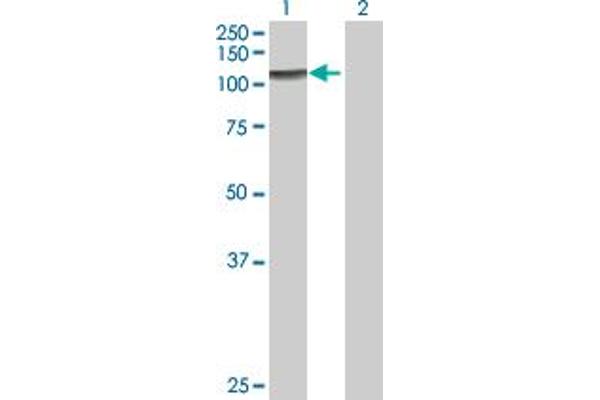 ZFYVE28 antibody  (AA 1-887)