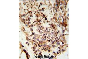 Formalin-fixed and paraffin-embedded human testis tissue reacted with ACR Antibody , which was peroxidase-conjugated to the secondary antibody, followed by DAB staining. (Achaete-scute complex protein T5 (AC) (AA 387-416), (C-Term) antibody)