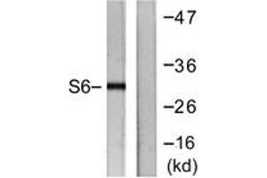 Western blot analysis of extracts from HeLa cells, treated with TNF-a 20ng/ml 2', using S6 Ribosomal Protein (Ab-240) Antibody. (RPS6 antibody  (AA 191-240))