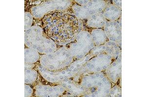 Immunohistochemistry of paraffin-embedded mouse kidney using NTF3 antibody (ABIN3017531, ABIN3017532, ABIN3017533 and ABIN6220139) at dilution of 1:100 (40x lens).