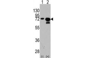 Western Blotting (WB) image for anti-Heat Shock 70kDa Protein 1A (HSPA1A) antibody (ABIN3003300) (HSP70 1A antibody)