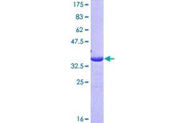 Annexin IV Protein (AA 224-319) (GST tag)