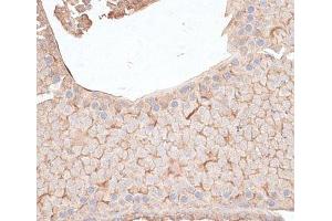 Immunohistochemistry of paraffin-embedded Mouse testis using KIAA1524 Polyclonal Antibody at dilution of 1:100 (40x lens). (KIAA1524 antibody)