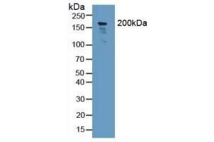 Detection of NID2 in Human Lung Tissue using Polyclonal Antibody to Nidogen 2 (NID2)