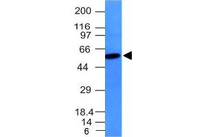 Western Blot Analysis Raji cell lysate Vimentin Mouse Monoclonal Antibody (VM452). (Vimentin antibody)