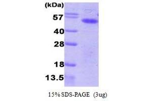 SDS-PAGE (SDS) image for Aurora Kinase A (AURKA) (AA 1-403) protein (His tag) (ABIN667117) (Aurora A Protein (AA 1-403) (His tag))