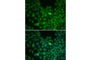 Immunofluorescence analysis of U2OS cells using CLU antibody. (Clusterin antibody)