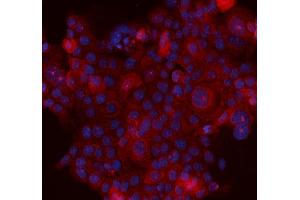 anti-serpin Peptidase Inhibitor, Clade B (Ovalbumin), Member 5 (SERPINB5) (AA 1-350) antibody