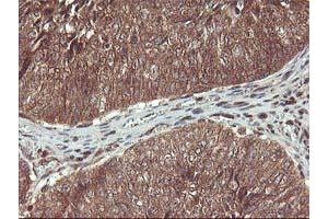Image no. 13 for anti-Haloacid Dehalogenase-Like Hydrolase Domain Containing 1 (HDHD1) antibody (ABIN1498623)
