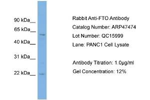 WB Suggested Anti-FTO  Antibody Titration: 0.