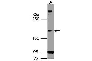 WB Image Sample (30 ug of whole cell lysate) A: H1299 5% SDS PAGE antibody diluted at 1:500