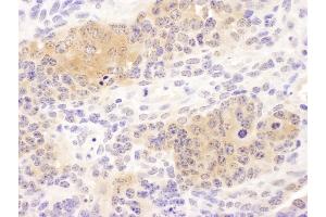 Immunohistochemistry (IHC) image for anti-Chaperonin Containing TCP1, Subunit 8 (Theta) (CCT8) (AA 448-498) antibody (ABIN7453620) (CCT8 antibody  (AA 448-498))