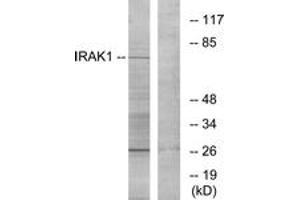 Western blot analysis of extracts from NIH-3T3 cells, using IRAK1 (Ab-209) Antibody. (IRAK1 antibody  (AA 175-224))