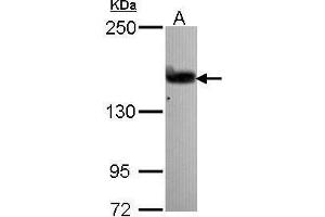 WB Image Sample (30 ug of whole cell lysate) A: A431 , 5% SDS PAGE antibody diluted at 1:1000