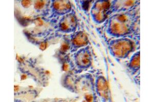 IHC-P analysis of stomach tissue, with DAB staining. (CCL13 antibody  (AA 24-98))