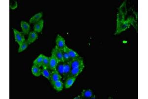 Immunofluorescent analysis of HepG2 cells using ABIN7158291 at dilution of 1:100 and Alexa Fluor 488-congugated AffiniPure Goat Anti-Rabbit IgG(H+L) (LAIR1 antibody  (AA 22-165))