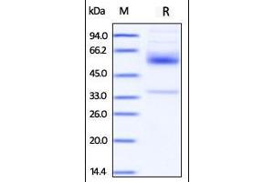 Human CD79B, Fc Tag on SDS-PAGE under reducing (R) condition. (CD79b Protein (AA 29-159) (Fc Tag))