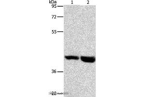 Western blot analysis of Mouse heart and liver tissue, using GPR182 Polyclonal Antibody at dilution of 1:1000 (G Protein-Coupled Receptor 182 antibody)