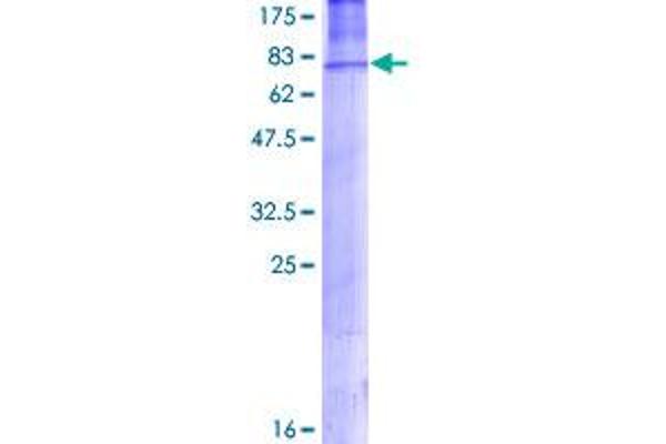 AP2M1 Protein (AA 1-435) (GST tag)